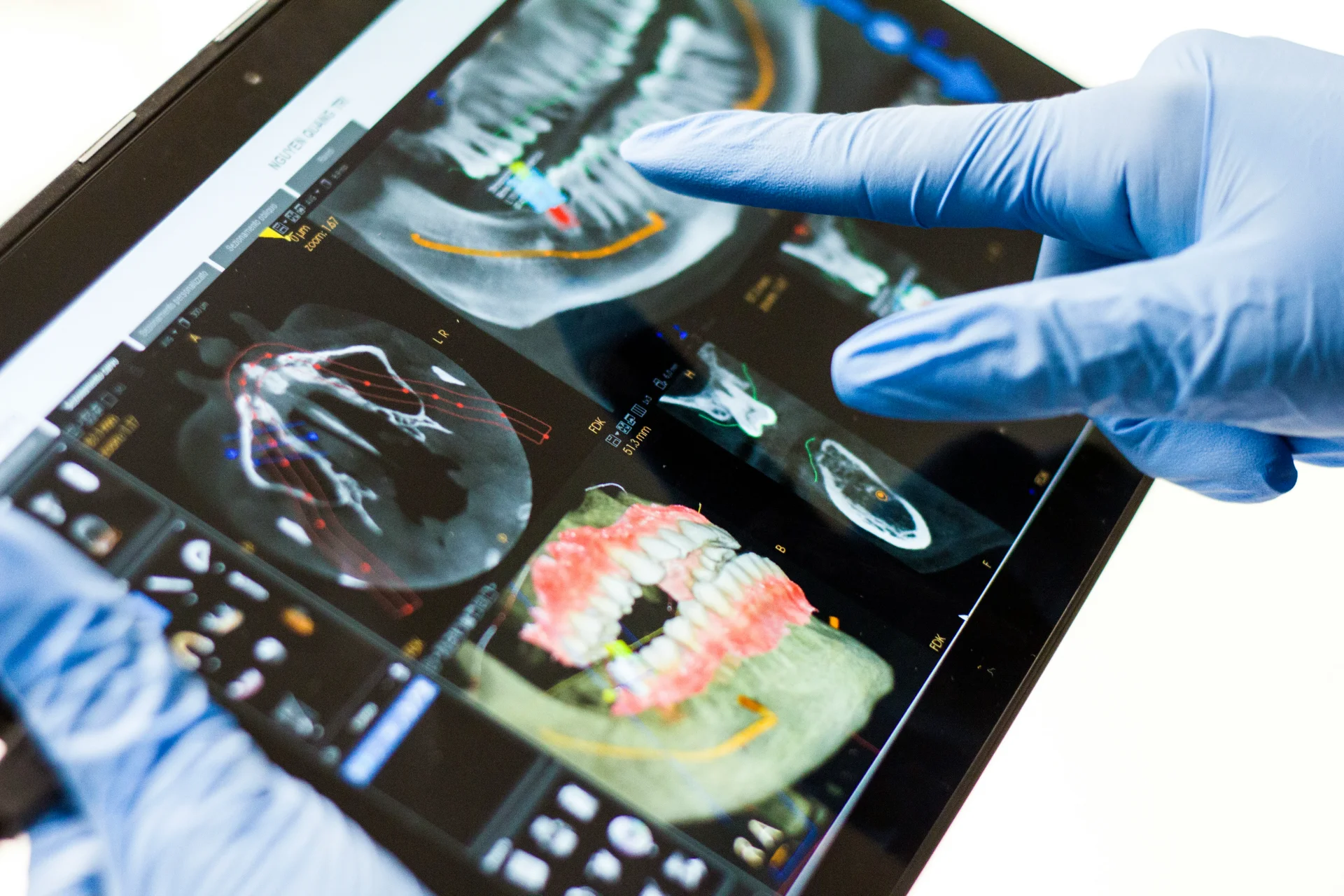 AI in Dentistry Explained: Benefits, Applications & Future