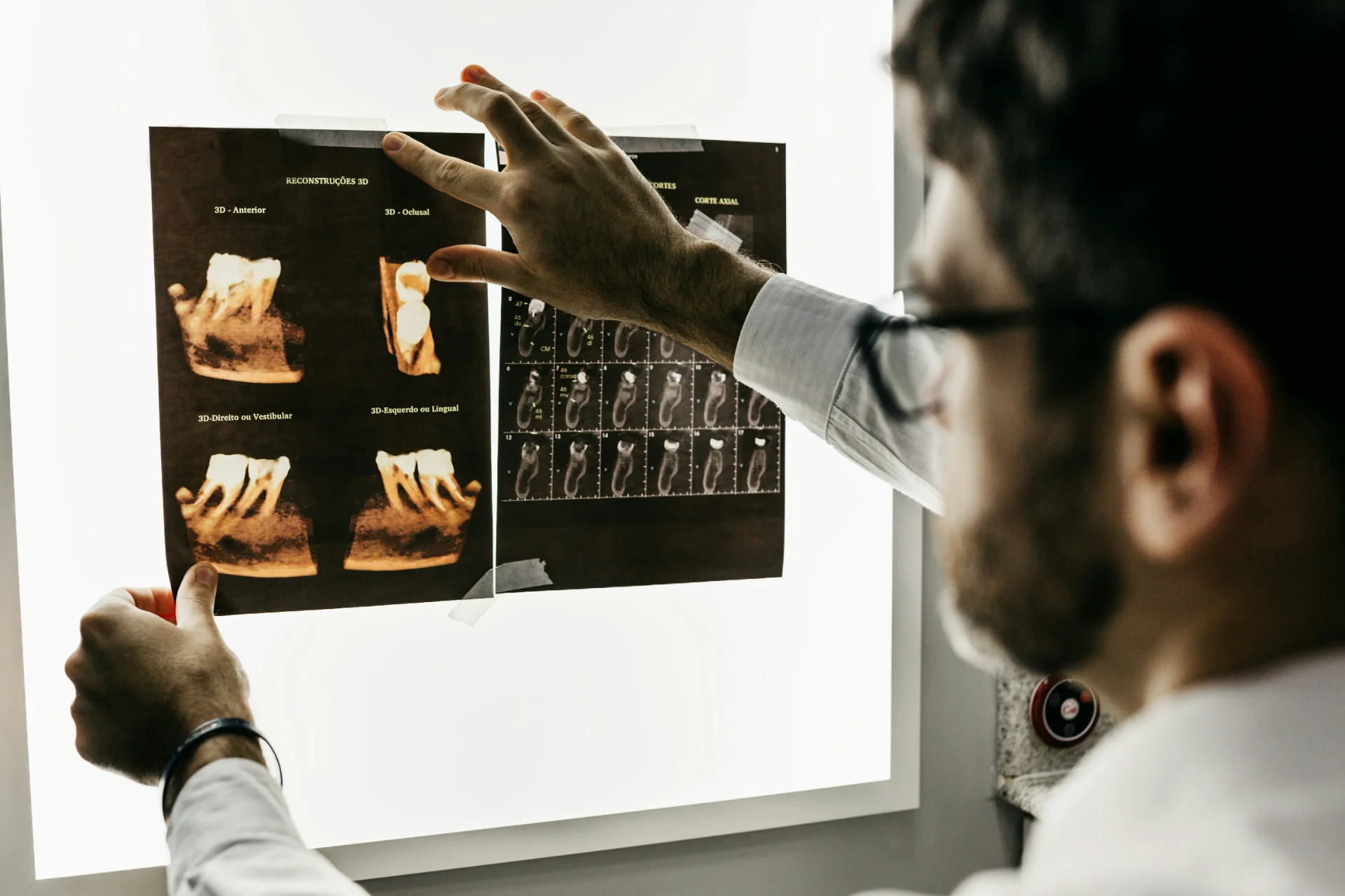 What Is Radiographic Imaging: All You Need to Know