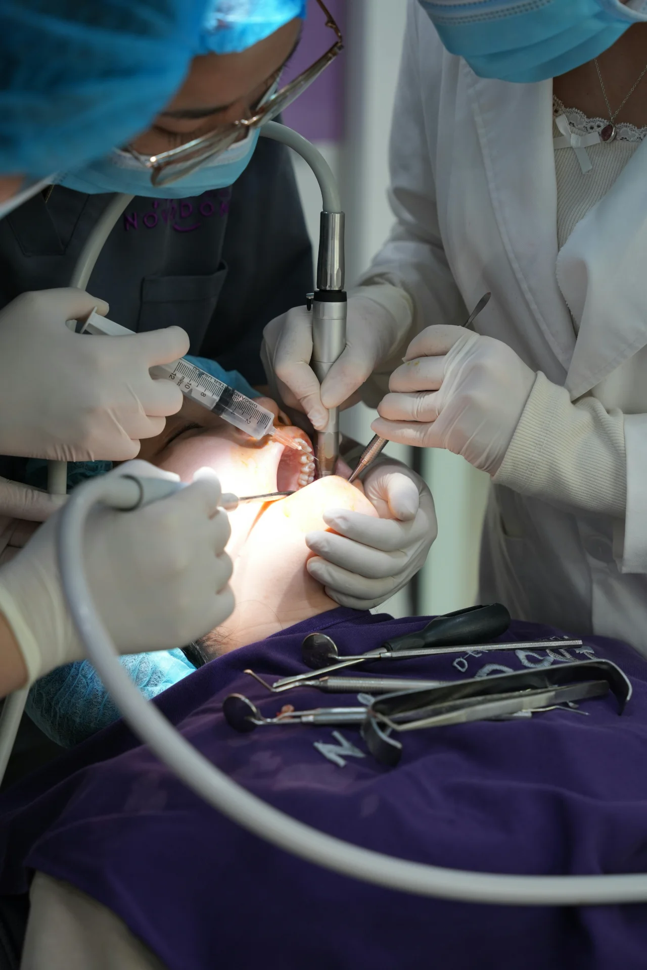 Recovery Timeline After Wisdom Teeth Surgery