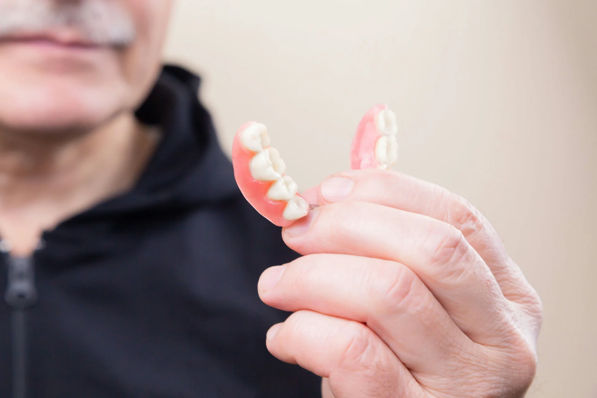 Comparing Same-Day Dentures and Traditional Options