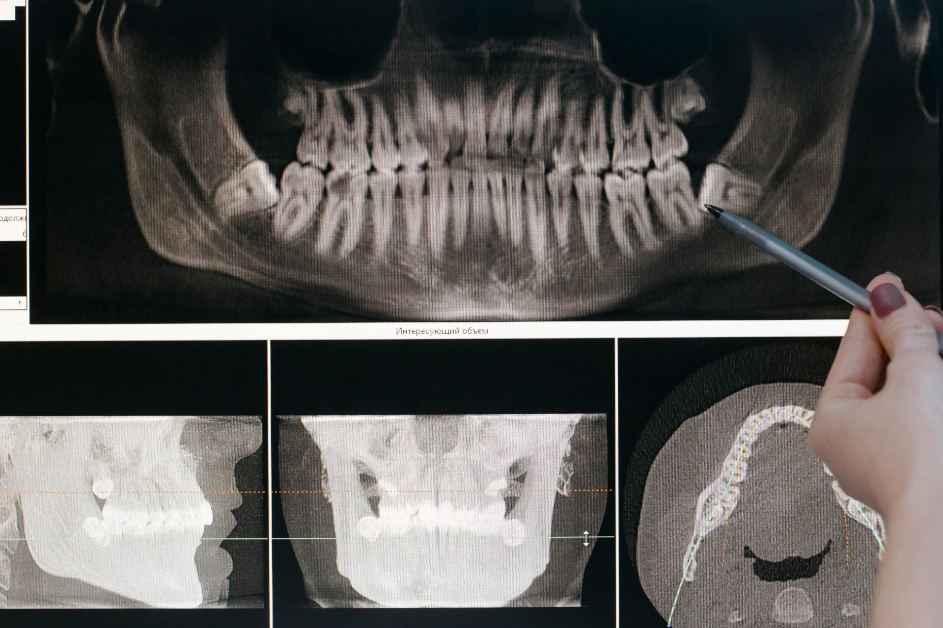 How To Get X-Ray Certification for Dental Professionals