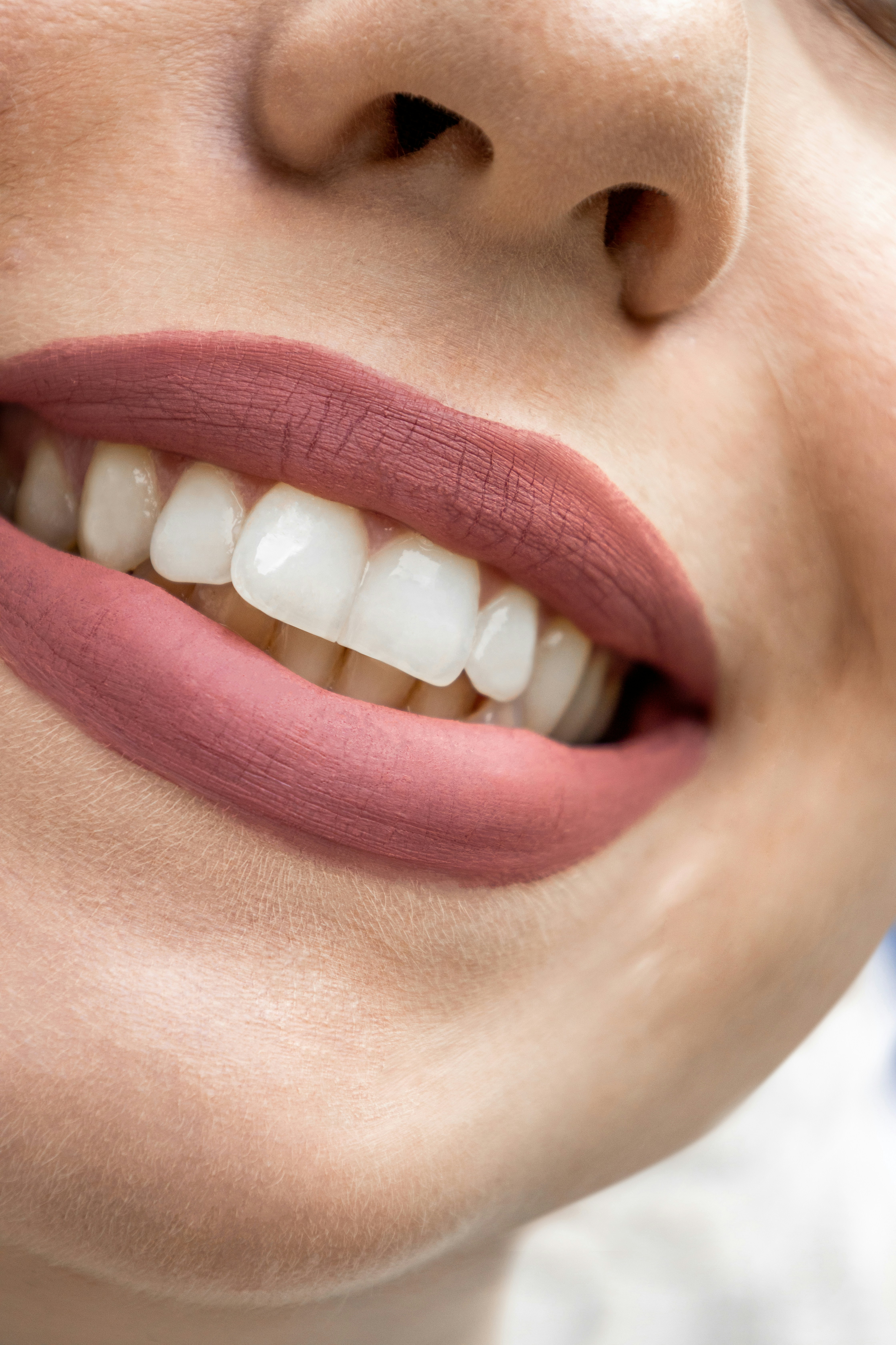 Dentist's Guide To What To Do After Removing Teeth Whitening Strips