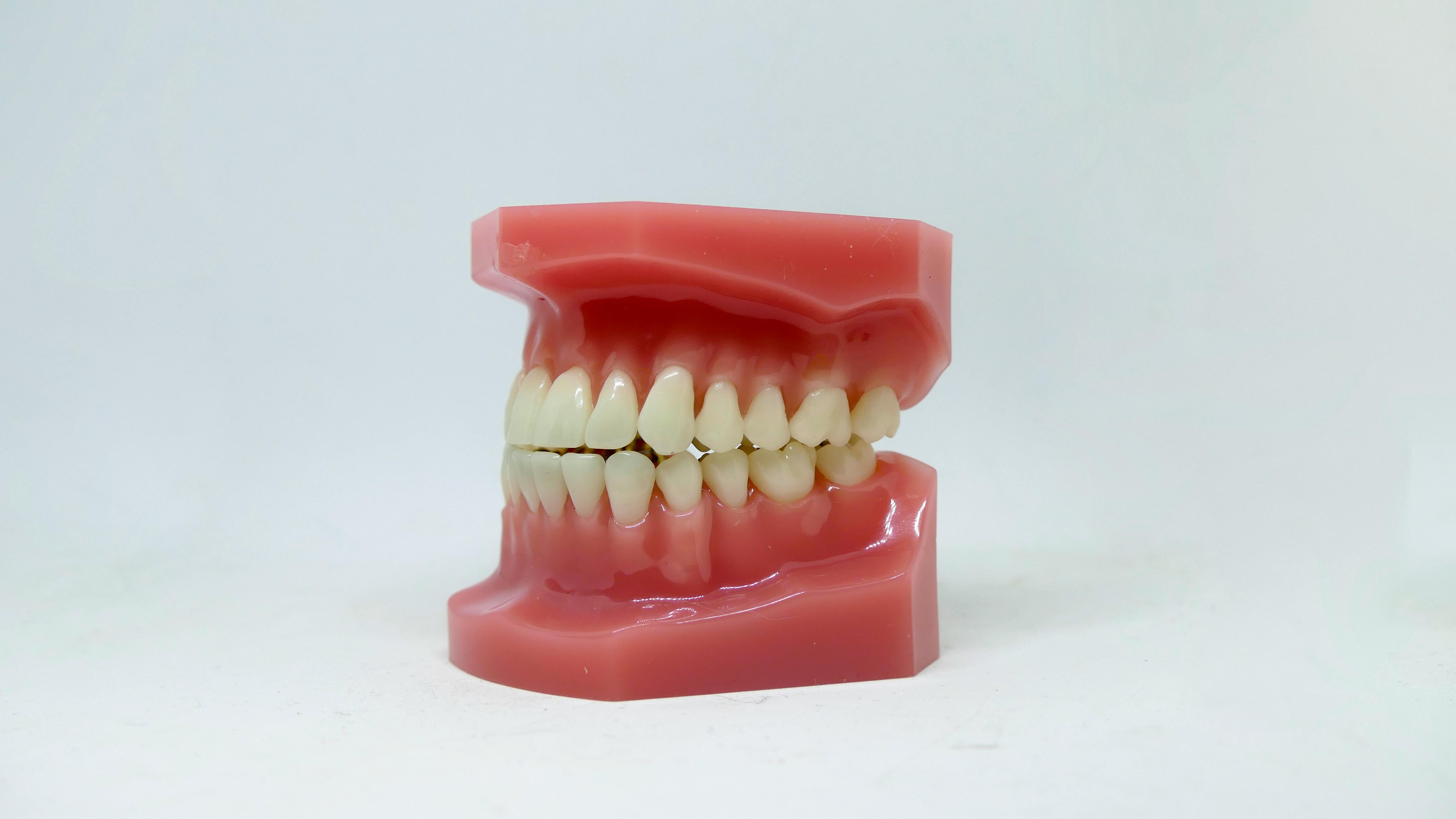 Malocclusion Class III: Types, Causes, And Treatment Options