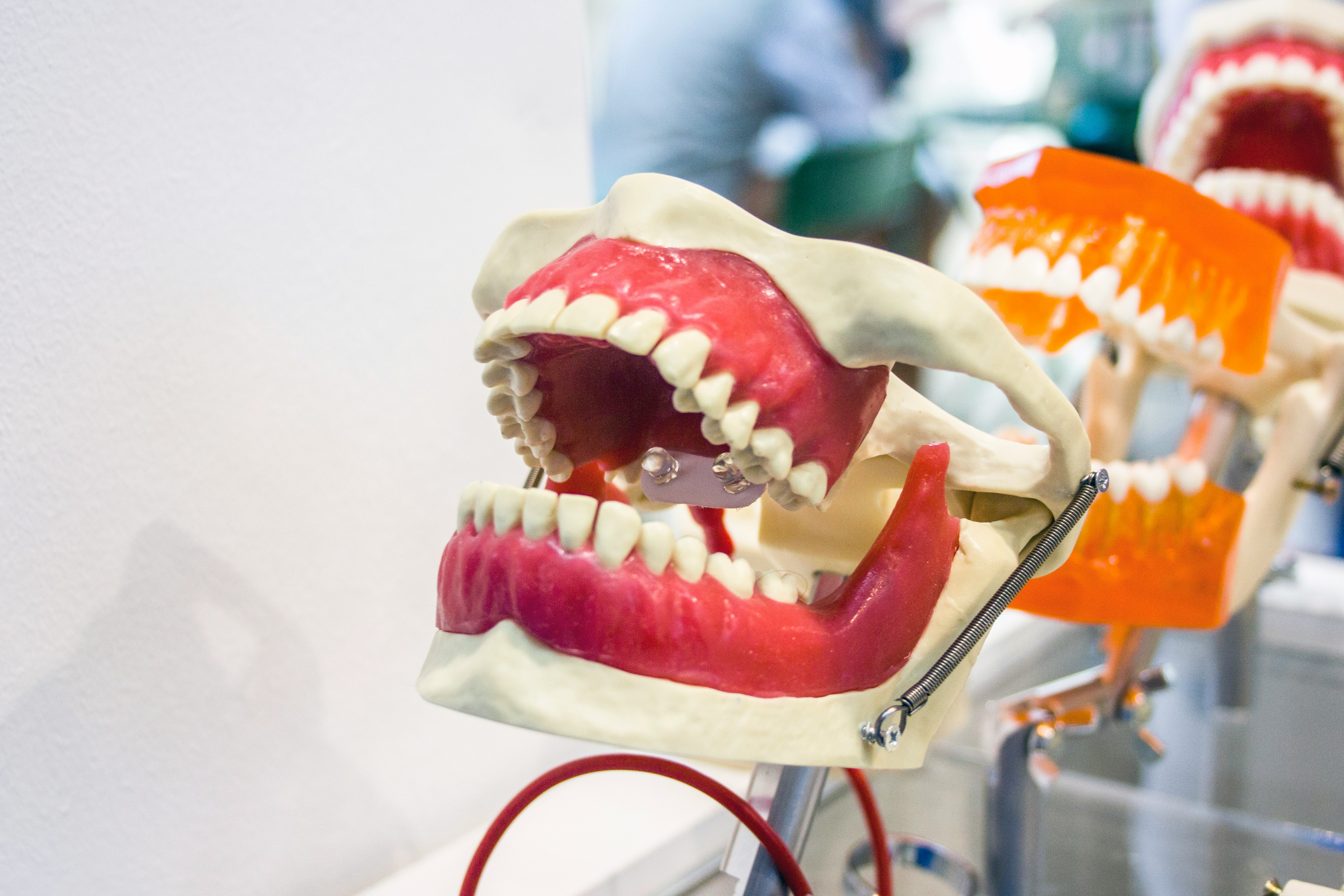 Dental Chart Explained: Tooth Numbering and Periodontal Charts