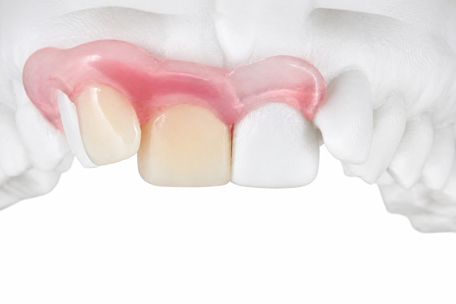 Flexible Dentures: Types, Cost, and How They Compare