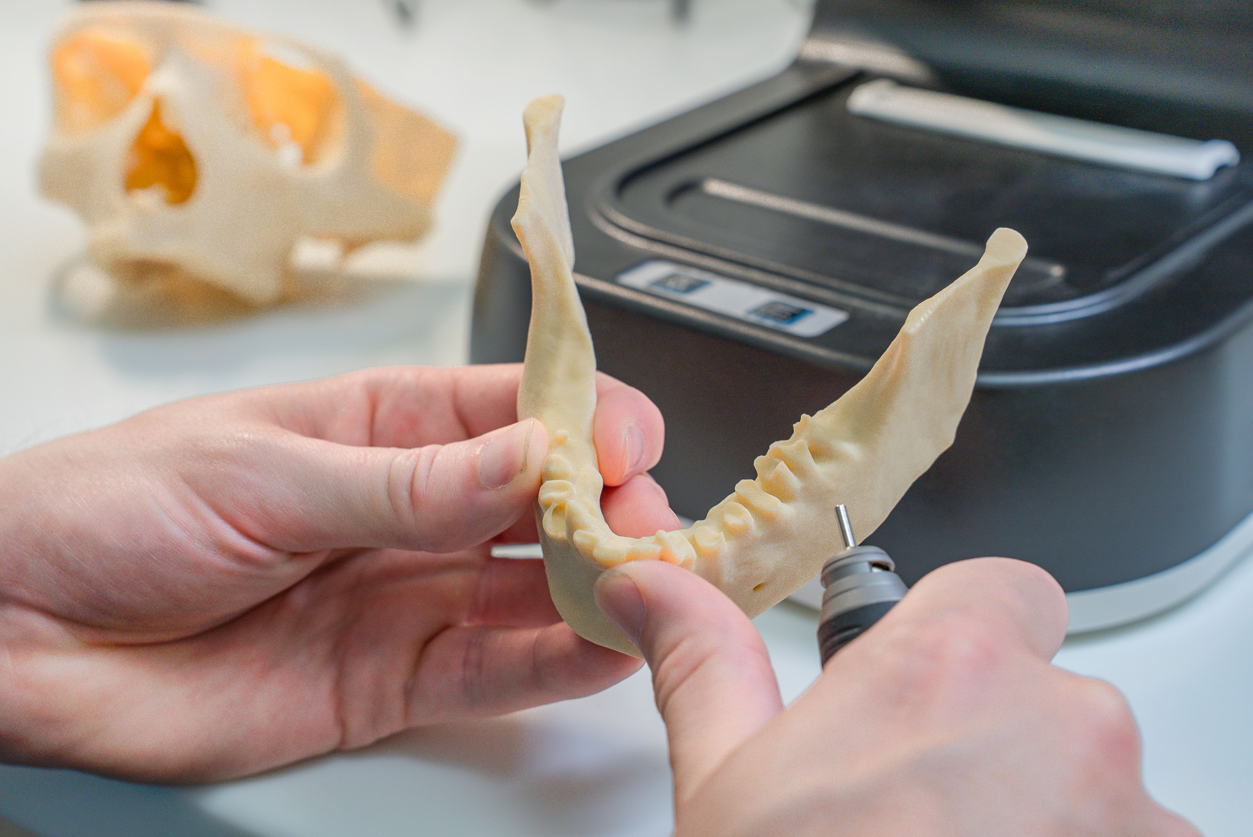 Does Your Dental Practice Need A 3D Dental Printer?