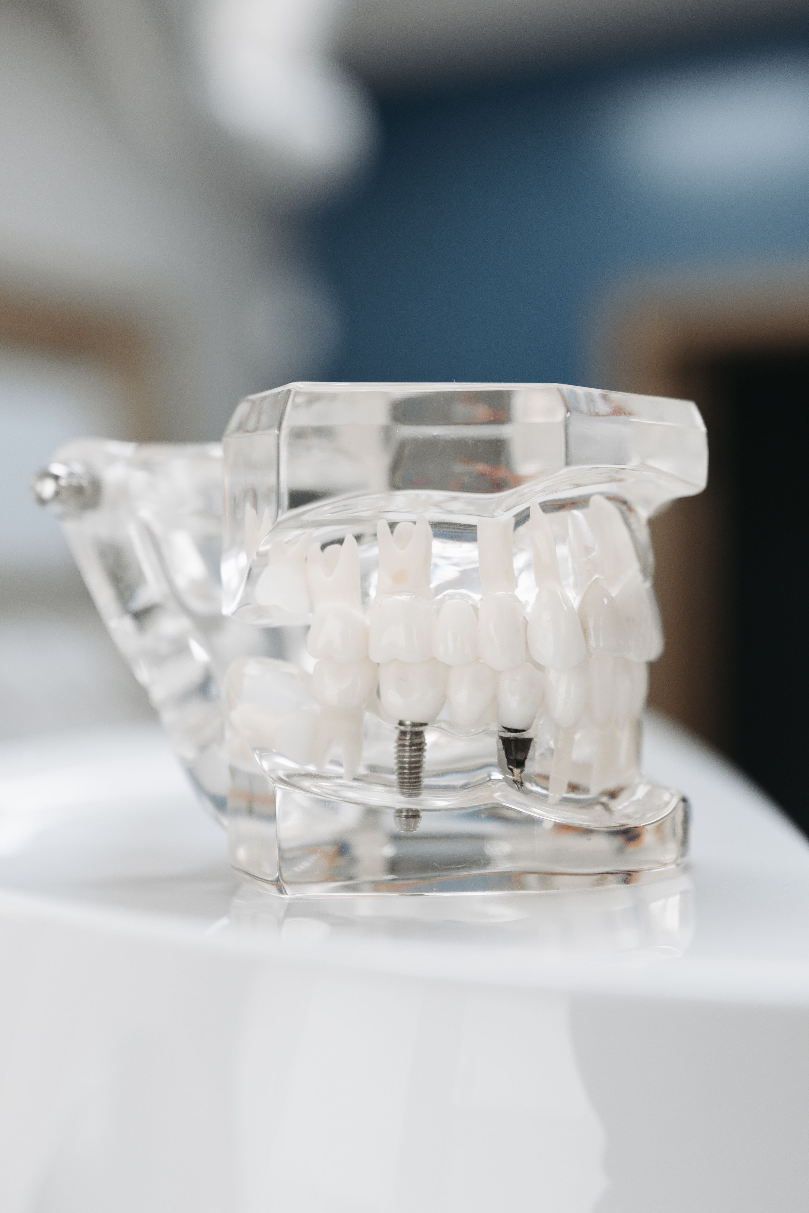 Zirconia Teeth Implants: Overview & Costs in The US