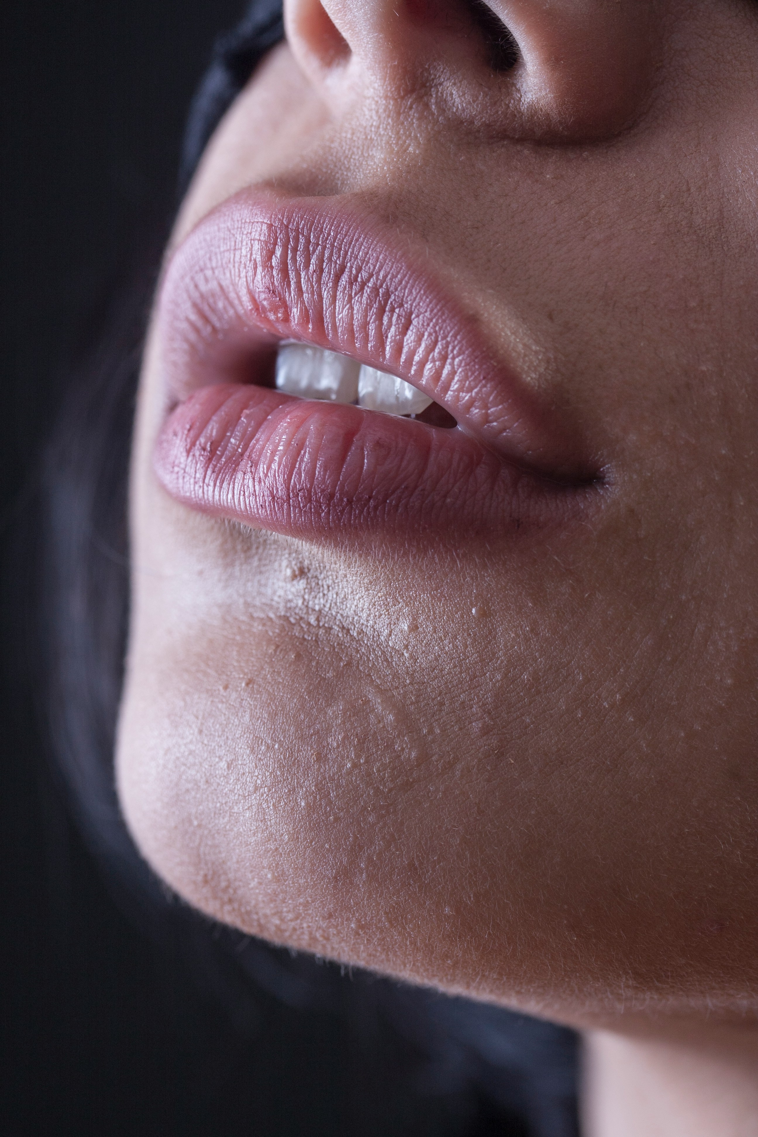 Metallic Taste In Mouth: Causes, Symptoms, And Treatment
