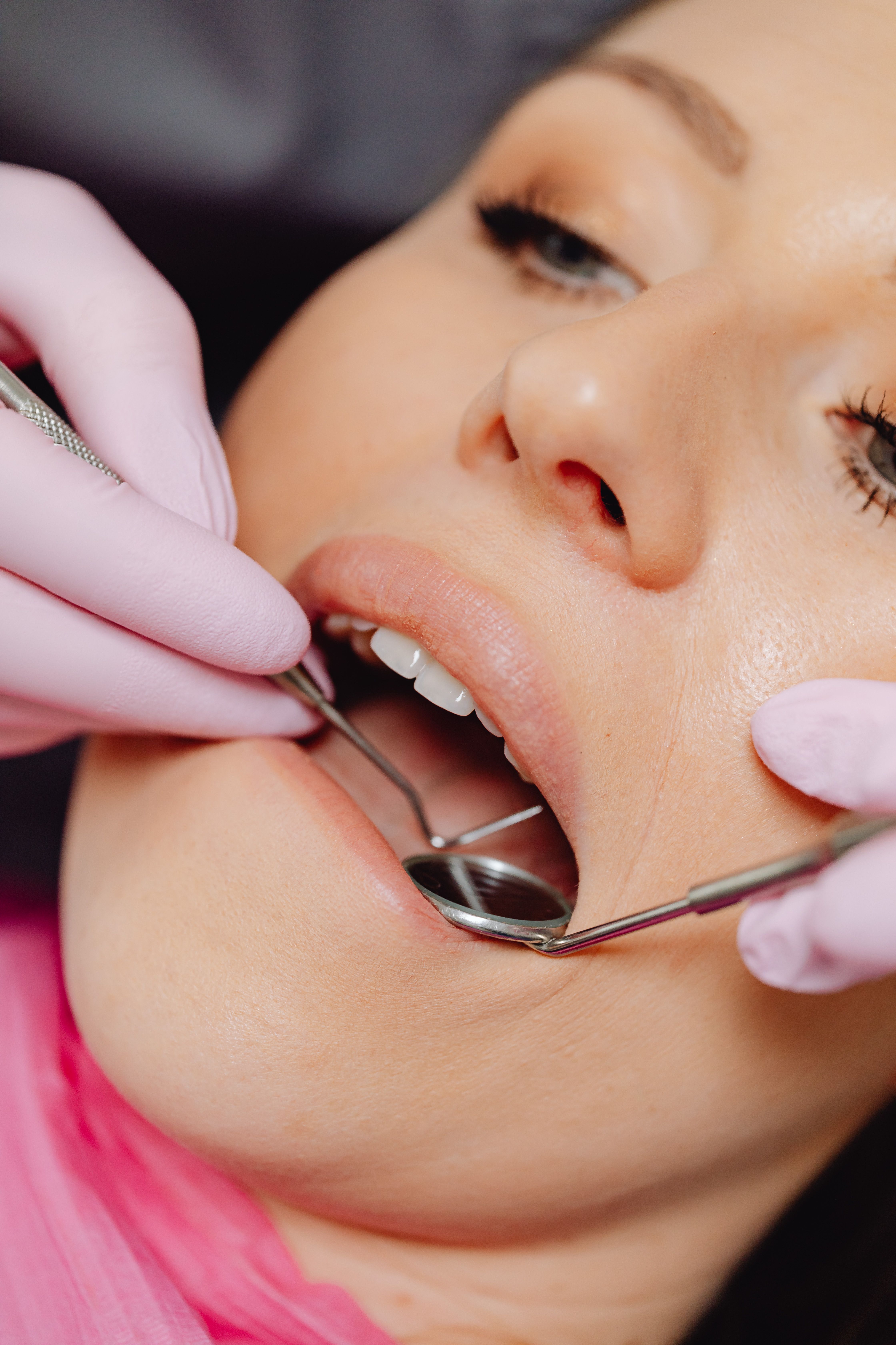 What Is A Cavity? Signs, Stages, And Treatment