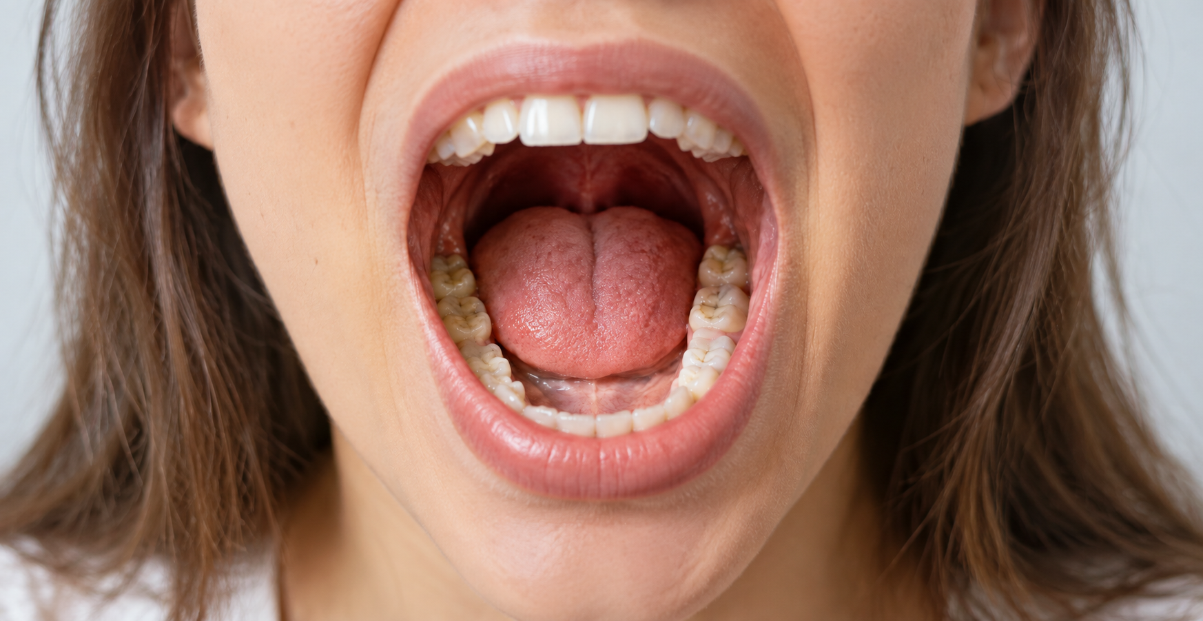 What Dentists Need to Know About The Oral Virome