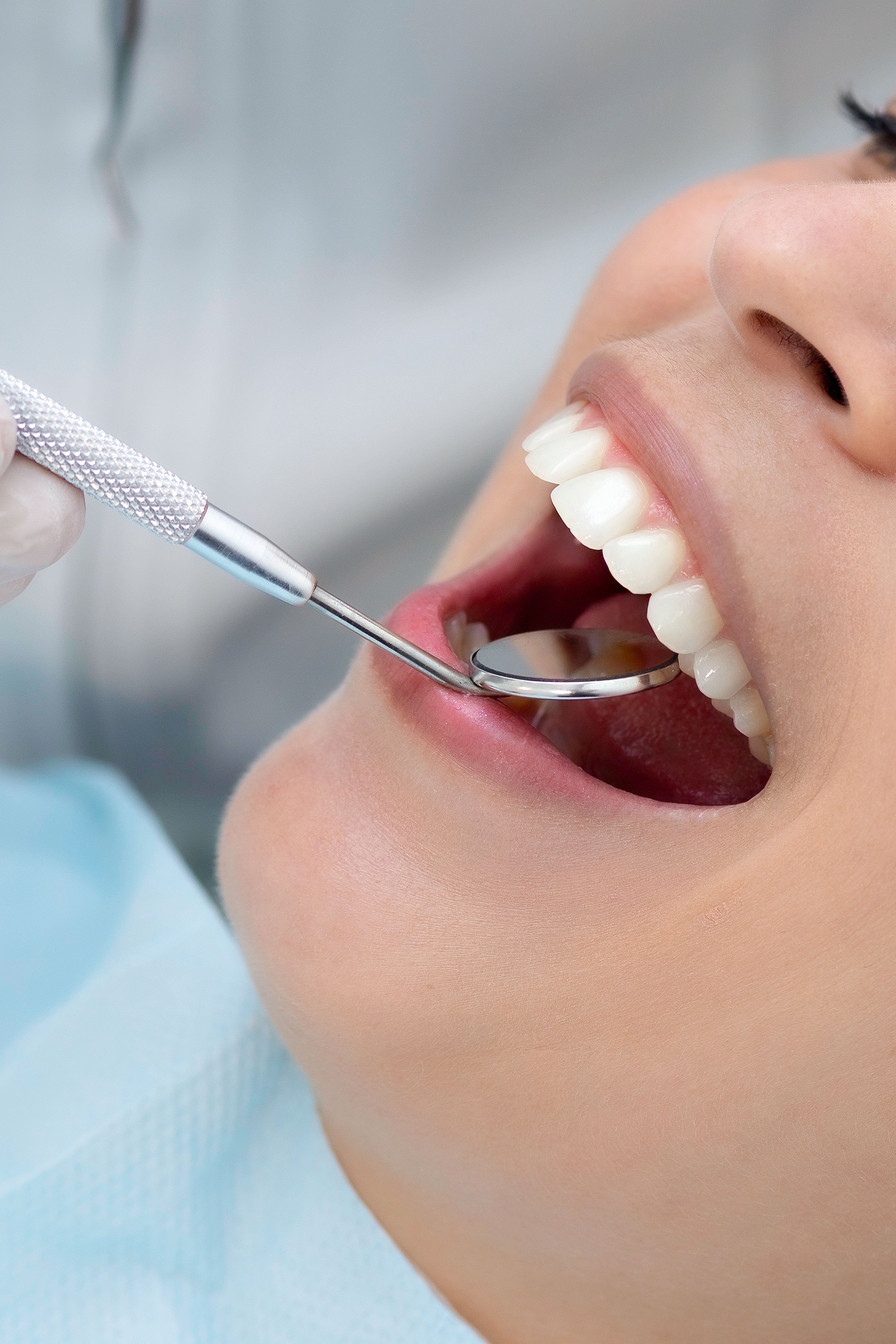 Dentist Answers: Why Does My Tooth Feel Too High After a Filling?