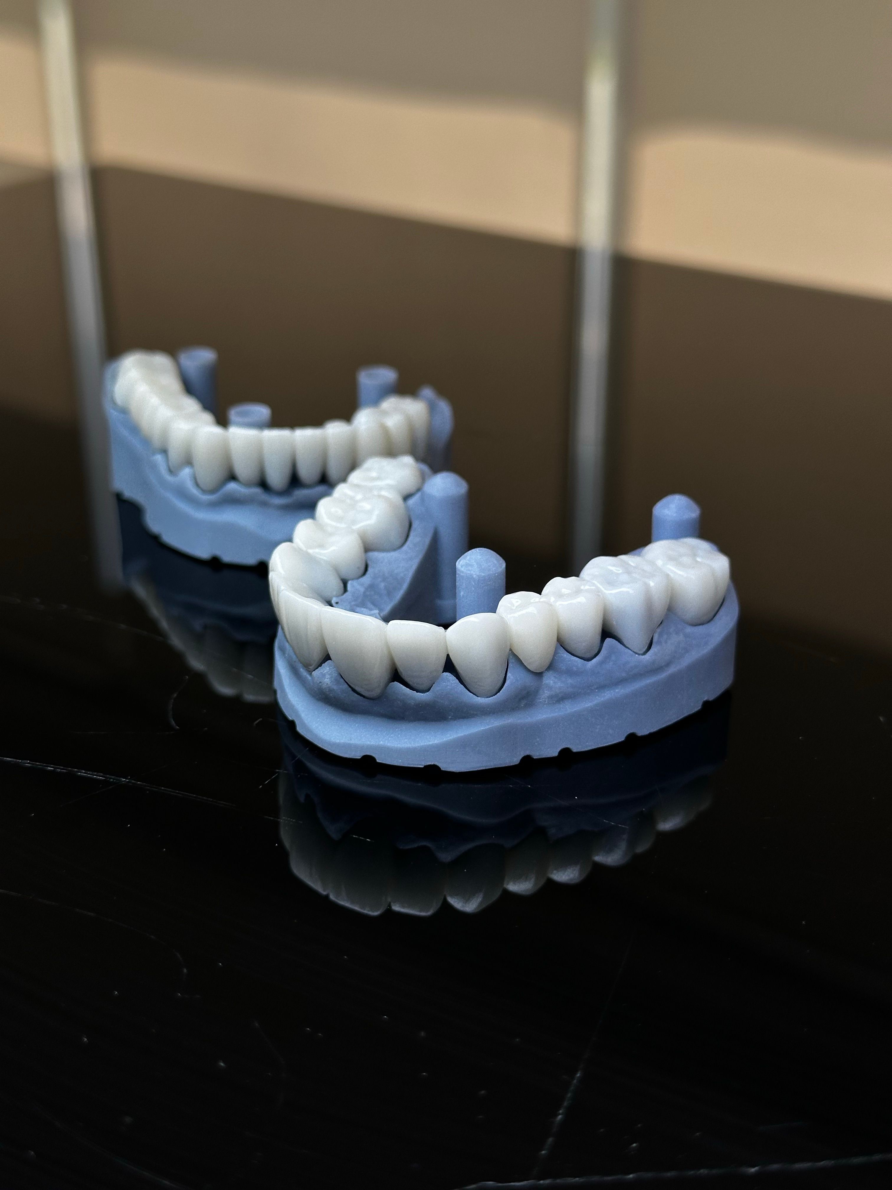 How to Bond Zirconia Crowns: Air Abrasion, MDP, and Cement Choice