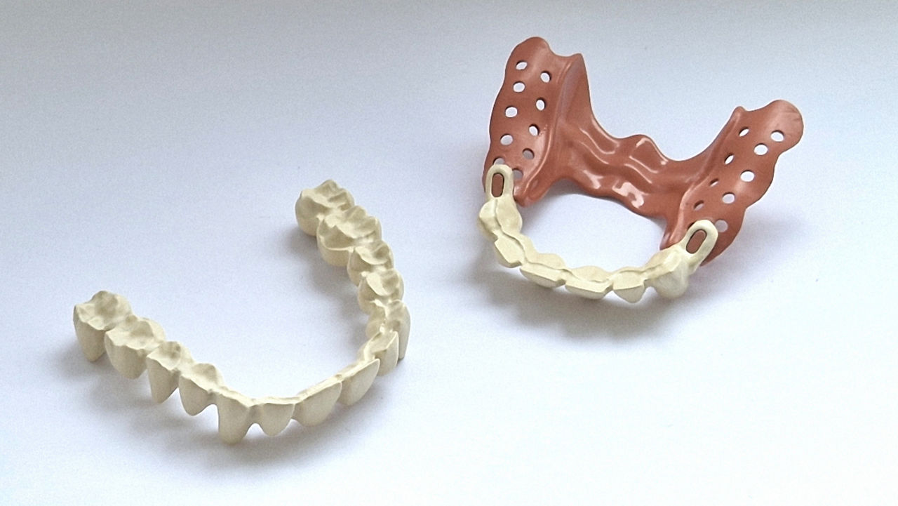 Evonik Introduces Two New PEEK Materials for Long-Term Dental Prosthetics